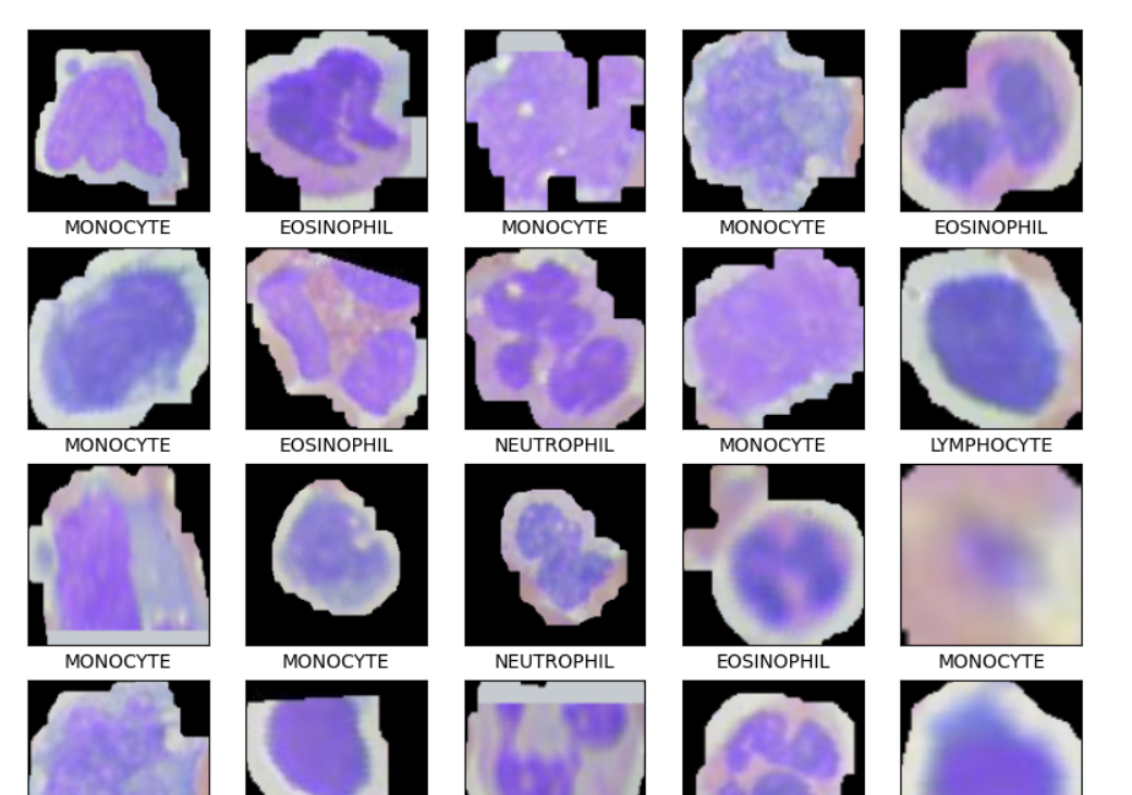 Blood Cell Image Classification